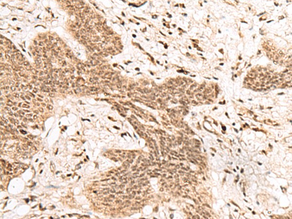 FAM111B Polyclonal Antibody (E-AB-19841)