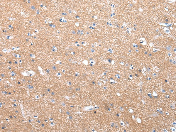 COLEC12 Polyclonal Antibody (E-AB-17716)