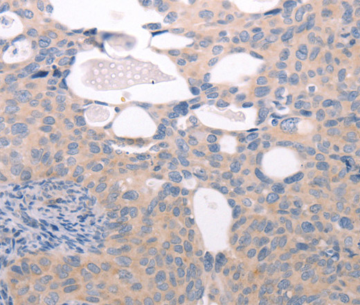 ABCF1 Polyclonal Antibody (E-AB-10698)