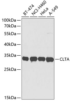 CLTA Polyclonal Antibody (E-AB-62046)