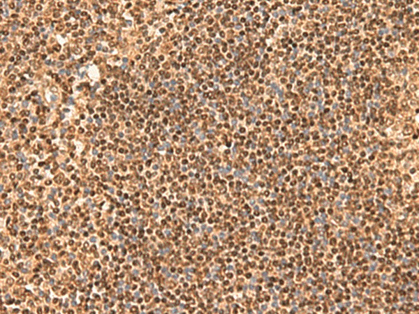 SIX6 Polyclonal Antibody (E-AB-19997)