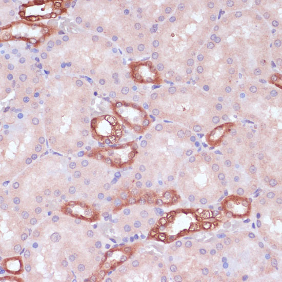 UGT2B15 Polyclonal Antibody (E-AB-66887)