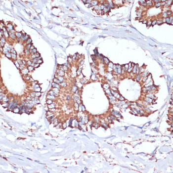UBE2O Polyclonal Antibody (E-AB-67078)