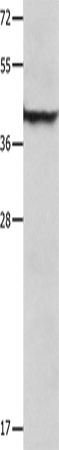 SERPINB5 Polyclonal Antibody (E-AB-14208)