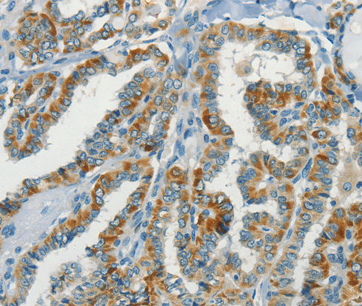 NPAP1 Polyclonal Antibody (E-AB-16213)