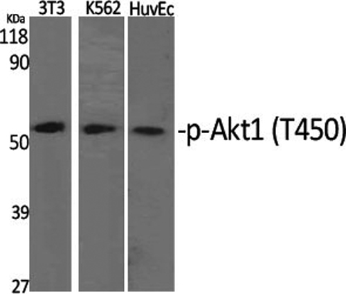 Phospho-AKT1 (Thr450) Polyclonal Antibody (E-AB-20804)