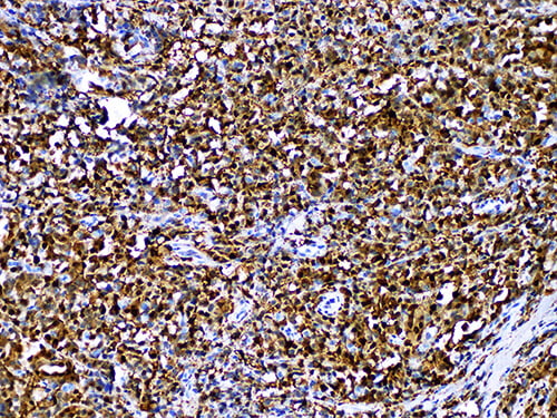 S100 Monoclonal Antibody (ELAB6217-M)