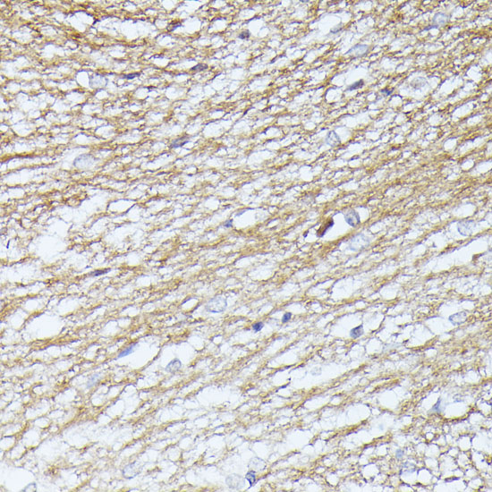 SEPT5 Polyclonal Antibody (E-AB-64397)