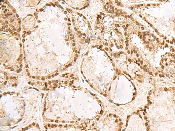 KRR1 Polyclonal Antibody (E-AB-52736)
