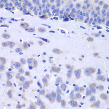 HTT Polyclonal Antibody (E-AB-67924)