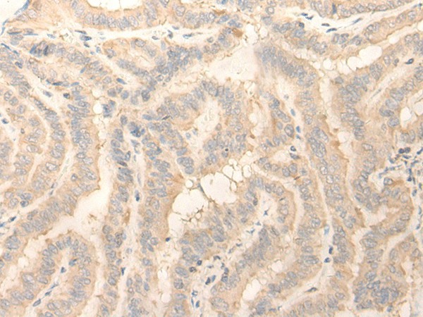 ERP27 Polyclonal Antibody (E-AB-52590)