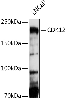 CDK12 Polyclonal Antibody (E-AB-90992)