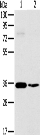 OTUB1 Polyclonal Antibody (E-AB-11463)