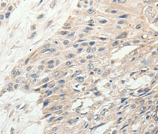 SLC9A7 Polyclonal Antibody (E-AB-16067)