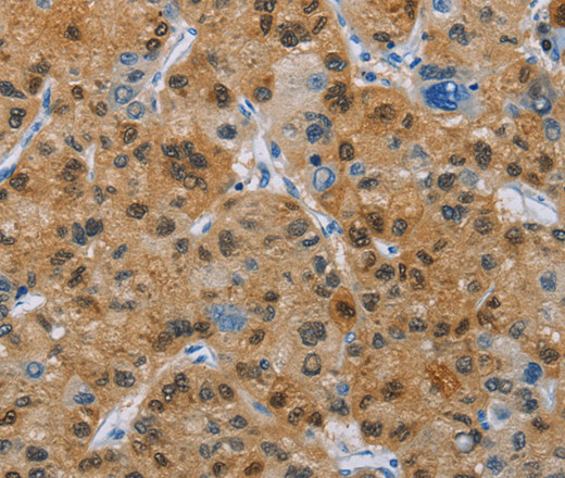 CD272 Polyclonal Antibody (E-AB-11056)