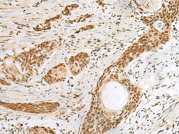 PNRC2 Polyclonal Antibody (E-AB-18895)