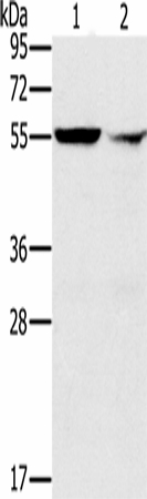 PPM1F Polyclonal Antibody (E-AB-16729)