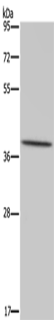MT-ND1 Polyclonal Antibody (E-AB-13427)