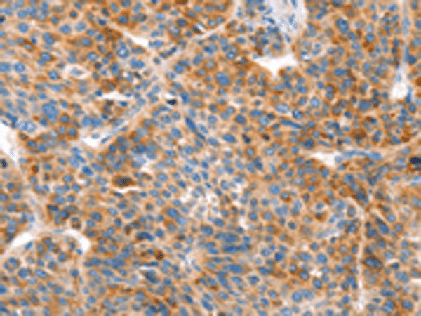 VTN Polyclonal Antibody (E-AB-53203)