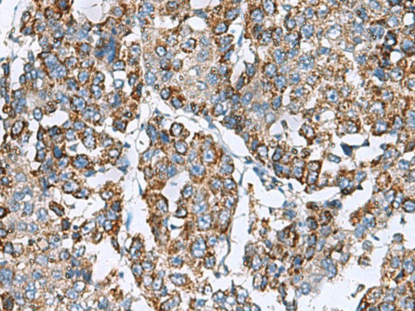 PRELID3B Polyclonal Antibody (E-AB-19156)