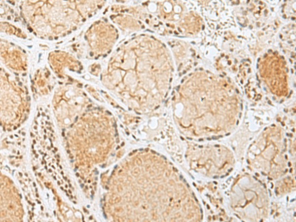 HIST1H2BK Polyclonal Antibody (E-AB-52805)