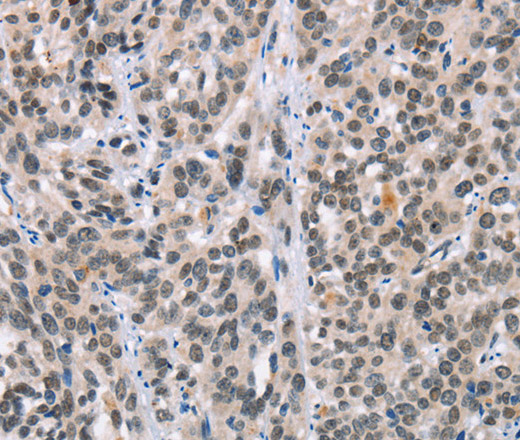 ADNP Polyclonal Antibody (E-AB-16260)