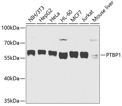PTBP1 Polyclonal Antibody (E-AB-62185)