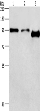 PIP5K1C Polyclonal Antibody (E-AB-13020)
