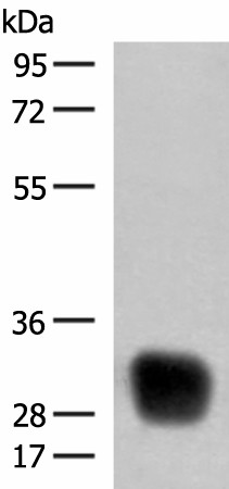 HLA-DRB4 Polyclonal Antibody (E-AB-52725)