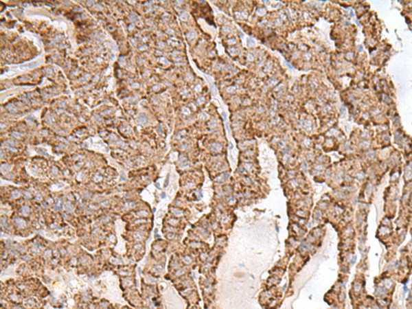 AP1S1 Polyclonal Antibody (E-AB-52688)