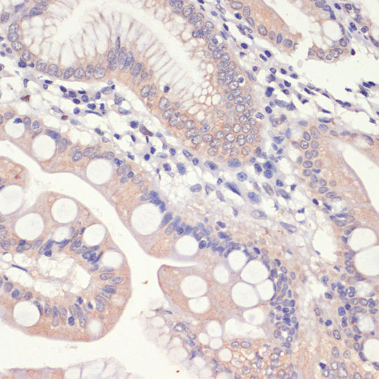 HMGCR Polyclonal Antibody (E-AB-66762)