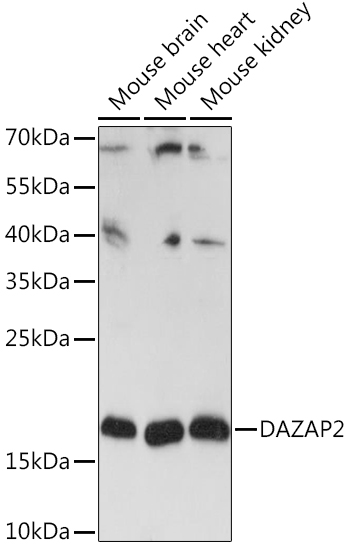 DAZAP2 Polyclonal Antibody (E-AB-90775)