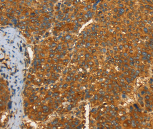 PFKFB1 Polyclonal Antibody (E-AB-13026)