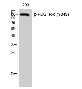 Phospho-PDGFRA (Tyr849) Polyclonal Antibody (E-AB-21070)