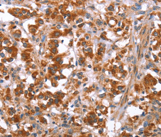 GLMN Polyclonal Antibody (E-AB-16459)