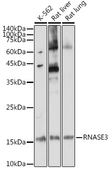 RNASE3 Polyclonal Antibody (E-AB-90865)