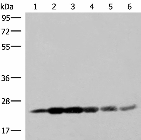 GSTK1 Polyclonal Antibody (E-AB-18949)