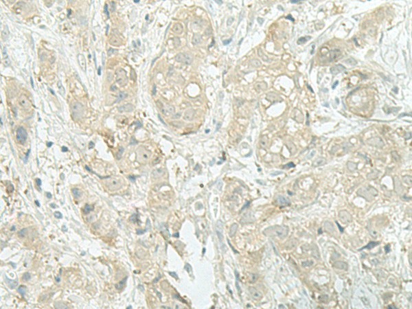 MIEN1 Polyclonal Antibody (E-AB-18767)