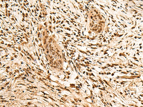 PPM1G Polyclonal Antibody (E-AB-18846)
