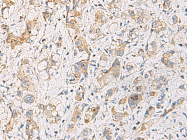 FYCO1 Polyclonal Antibody (E-AB-19197)