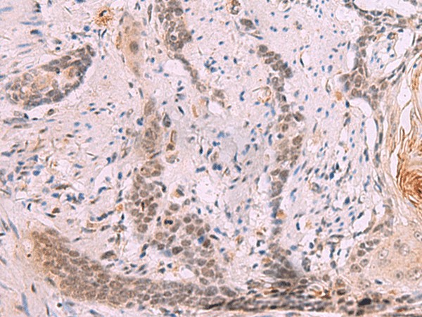INO80 Polyclonal Antibody (E-AB-52023)