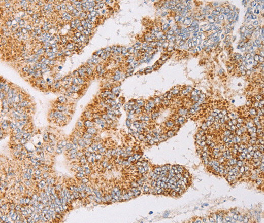 YARS2 Polyclonal Antibody (E-AB-10912)