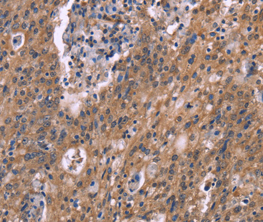 HSD11B2 Polyclonal Antibody (E-AB-13311)