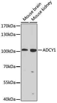 ADCY1 Polyclonal Antibody (E-AB-63973)