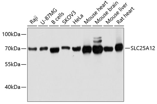 SLC25A12 Polyclonal Antibody (E-AB-63584)
