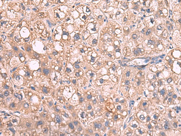 JAZF1 Polyclonal Antibody (E-AB-52052)