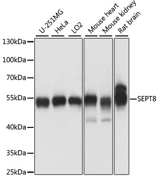 SEPT8 Polyclonal Antibody (E-AB-65176)