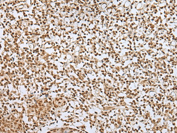 ZNF354A Polyclonal Antibody (E-AB-52385)