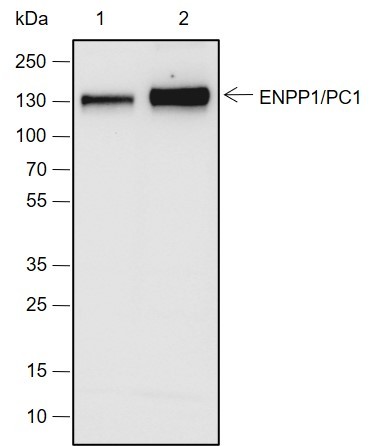 Recombinant ENPP1/PC1 Monoclonal Antibody (AN301994L)
