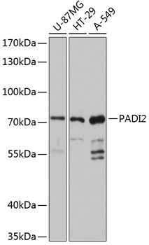 PADI2 Polyclonal Antibody (E-AB-90382)